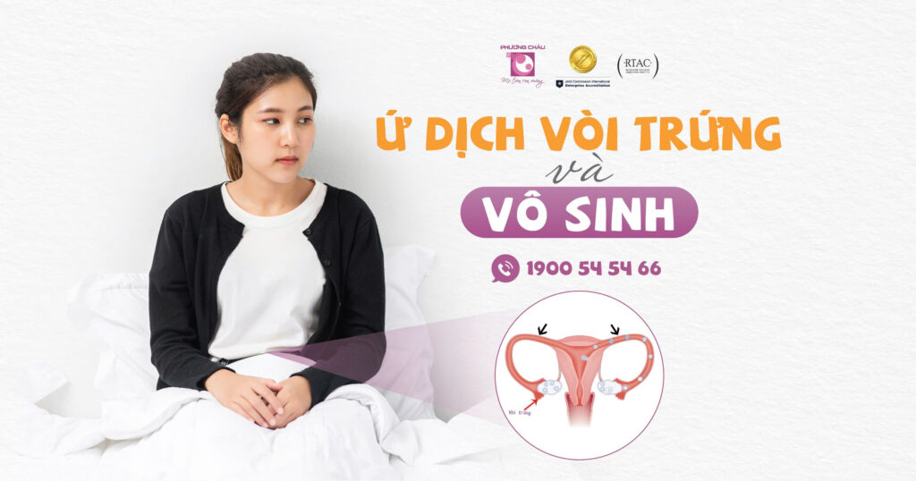 Ứ dịch vòi trứng và vô sinh