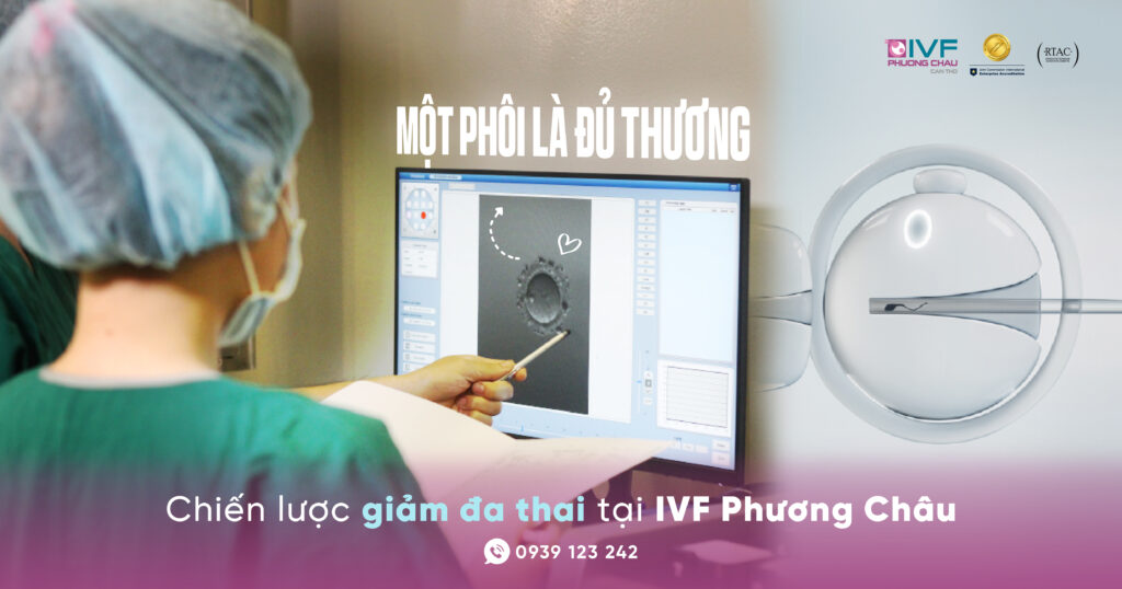 Chiến Lược Giảm Đa Thai Trong IVF: Tối Ưu Tỷ Lệ Thành Công Và An Toàn Cho Mẹ Và Bé