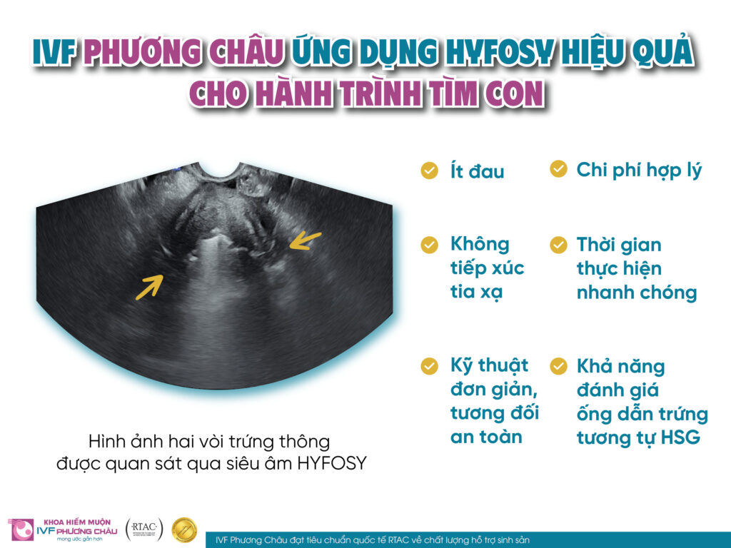 IVF Phương Châu ứng dụng HYFOSY hiệu quả cho hành trình tìm con